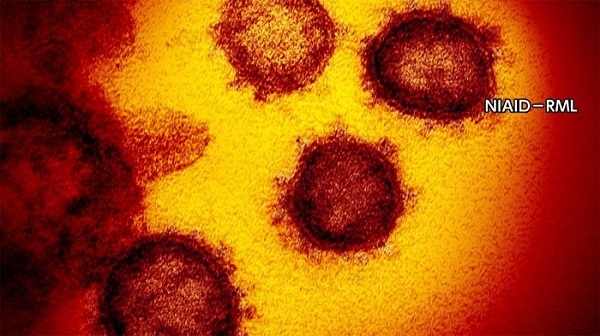 20200607武漢研究所のウイルス流出確定！英国とノルウェーの研究者が学術論文発表へ・トランプ10兆ドル請求